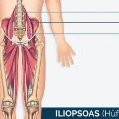 Der Iliopsoas-Muskel, auch Hüftbeuger genannt, mit dem prominenten psoas major, ist im menschlichen Becken und Oberschenkel dargestellt.