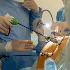 Chirurdzy w rękawiczkach i fartuchach przeprowadzają laparoskopię, używając narzędzi do precyzyjnej operacji.