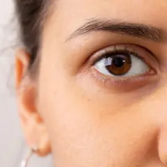 Nahaufnahme eines braunen Auges mit sichtbaren Schatten, die dunkel zwischen Nase und Auge liegen.