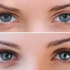 Avant/Après : des yeux bleus magnifiés par une extension de cils différente pose, pour un regard intense et glamour.