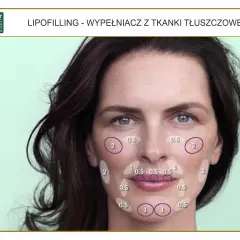 Liposukcja kawitacyjna: Ile zabiegów? Konkretne liczby i efekty