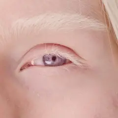 Blond włosy i jasna skóra otaczają piękne, fioletowo-szare oczy.