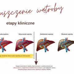 Grafika przedstawia etapy stłuszczenia wątroby: normalna, stłuszczona, zwłókniona i marska. Wczesne stadia są odwracalne.