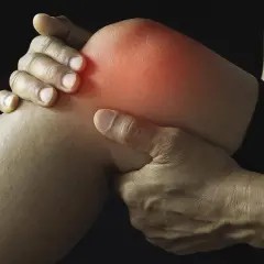 Schmerzendes Knie mit roter Hitze, die auf eine Schleimbeutelentzündung Knie Symptome hinweist. Hände umfassen das Gelenk.