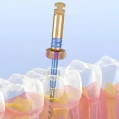 Ilustracja pokazuje leczenie kanałowe zęba krok po kroku. Widoczny jest specjalistyczny instrument wprowadzany do kanału korzeniowego.