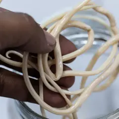 Mani che tengono un groviglio di vermi bianchi, simili a quelli che possono infestare i bambini, noti come ossiuri.