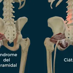 Músculos piramidales: diferencias clave entre piriforme y piramidal