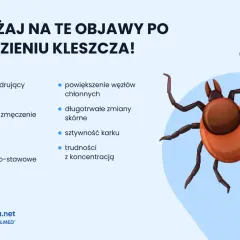Kleszcz: Jak usunąć bezpiecznie i uniknąć boreliozy? Poradnik