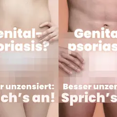 Genital-Psoriasis? Zwei Körper zeigen, dass es besser ist, offen darüber zu sprechen.