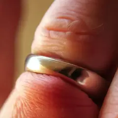 Zaciśnięta obrączka na palcu. Zastanawiasz się, ile kosztuje przecięcie obrączki na palcu w nagłym wypadku?