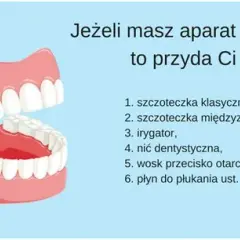 Aparat na zęby: Kiedy jest konieczny? Rozpoznaj objawy!