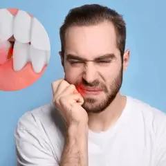 Uomo con dolore alla guancia, immagine ingrandita di un dente con gengiva infiammata. Sintomi di infezione dente sotto capsula.