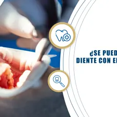 Procedimiento de endodoncia en un diente frontal. Dentista trabajando en la boca de un paciente.