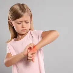 Une petite fille se gratte le poignet, le visage plissé par une forte démangeaison aux mains.
