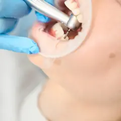 Ile trwa wizyta u dentysty? Poznaj czas trwania różnych zabiegów