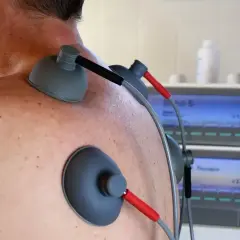 Elektrody TENS na plecach pacjenta. Choć zabieg jest bezpieczny, warto znać potencjalne prądy TENS skutki uboczne.