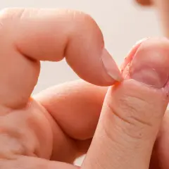 Zbliżenie na palec z widocznymi oznakami chorób paznokci, takich jak łuszczenie się skóry wokół paznokcia i jego nierówna powierzchnia.