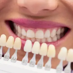 Wybielanie zębów u dentysty czy warto? Odkryj prawdę o skuteczności