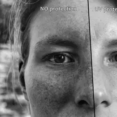 Porównanie skóry: po lewej widoczne przebarwienia i plamy spowodowane brakiem ochrony, po prawej skóra chroniona przed słońcem, bez oznak fotostarzenia.