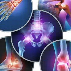 Por qué me duele los músculos: causas, síntomas y soluciones efectivas