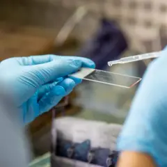 Jak zmniejszyć ryzyko raka? 12 kluczowych zaleceń