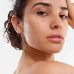 Une jeune femme au visage naturel, avec quelques imperfections, pose pour montrer comment avoir un beau visage.