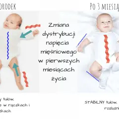 Wzmożone napięcie mięśniowe u niemowląt: Rozpoznaj objawy i działaj