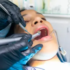 Dentysta wykonuje zabieg leczenia kanałowego. Pacjentka ma otwarte usta, a w nich wiertło stomatologiczne.