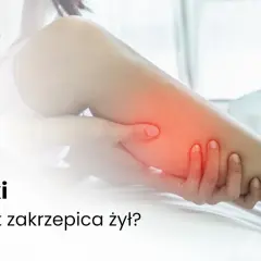 Ból łydek: przyczyny od zmęczenia po zakrzepicę. Kiedy iść do lekarza?