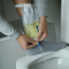 Mann entleert Urinbeutel, der mit einem Bauchdeckenkatheter verbunden ist. Erfahrungen damit sind oft eine Umstellung.
