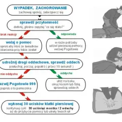 Jak reanimować niemowlaka – krok po kroku w nagłych sytuacjach ratujących życie