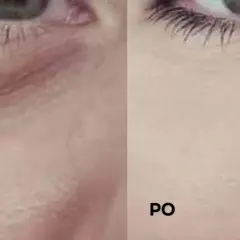 Przed i po: jak dbać o skórę pod oczami, by była gładka i wypoczęta. Widoczne wygładzenie zmarszczek.