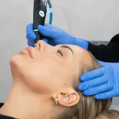 En kvinna får ansiktsbehandling med en fractional CO2 laser för hudförbättring.