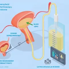 Ilustracja przedstawia pęcherz neurogenny, cewnik dopęcherzowy i system do wlewu leku, wskazując na ochronę nerek i łatwą aplikację w domu.