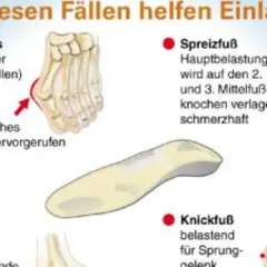 Weichpolstereinlagen helfen bei Hallux valgus, Spreizfuß, Hohlfuß und Knickfuß. Sie entlasten schmerzhafte Bereiche und beugen Verletzungen vor.