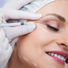 Kobieta uśmiecha się podczas zabiegu baby botox. Dłoń w rękawiczce trzyma strzykawkę z igłą, aplikując preparat w okolicę oka.