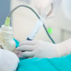 Mani guantate eseguono amniocentesi, un esame diagnostico che si fa solitamente tra la 15ª e la 20ª settimana di gravidanza.