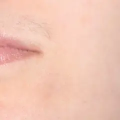 Zbliżenie na usta z błyszczącym błyszczykiem i delikatnym meszkiem, czyli wąsik u kobiet.