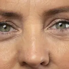 Occhi verdi con evidenti rughe glifiche, che raccontano storie di vita e sorrisi.