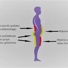 Schemat sylwetki z zaznaczonymi mięśniami. Widoczna pogłębiona lordoza lędźwiowa.