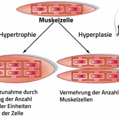 Sarkoplasmatische Hypertrophie: Muskelzelle wächst durch mehr kontraktile Einheiten. Daneben Hyperplasie: mehr Muskelzellen.