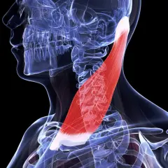 Anatomie du muscle sterno-cléido-mastoïdien, mis en évidence en rouge. Utile pour comprendre la douleur et le traitement associé.