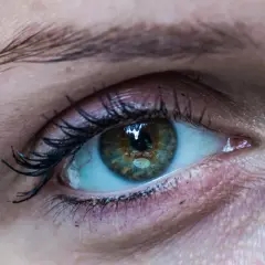 Nahaufnahme eines Auges mit einem leicht geschwollenen Augenlid. Die Iris ist grünlich-braun mit feinen Sprenkeln.