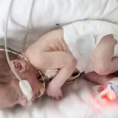 Ein winziges Baby, geboren in der 18. SSW, liegt in einem Inkubator, verbunden mit medizinischen Geräten.
