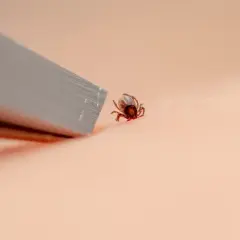 Zbliżenie na kleszcza na skórze obok metalowego narzędzia.