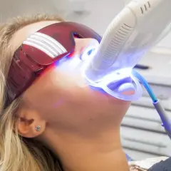 Kobieta w okularach ochronnych przechodzi zabieg wybielania lampą Beyond. Błękitne światło lampy rozjaśnia jej zęby.