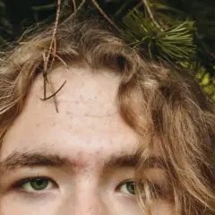 Primer plano de una persona con cabello rubio y ojos verdes, con **acné en la frente** y ramas de pino alrededor.
