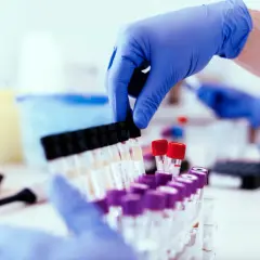 Ręce w niebieskich rękawiczkach przygotowują próbki do badań. W tle widać inne probówki, co sugeruje, że to test na narkotyki.