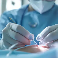 Mains gantées d'un chirurgien suturant une plaie avec précision. Le nombre de point de suture par cm est crucial pour une guérison optimale.