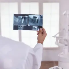 Dentysta analizuje RTG zęba z implantem, sprawdzając, ile kanałów ma 5.